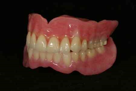 Types Of Partial Dentures Charlotte NC 28211